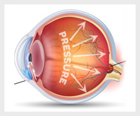 Eye anatomy and optical science illustration supplied with the product assets